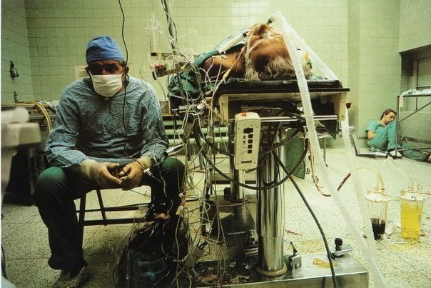 нимок хирурга после проведенной им 23-часовой операции на сердце.